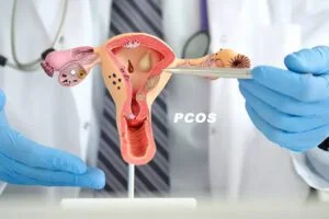 PCOS oile skin