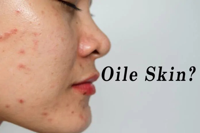 Oile skin